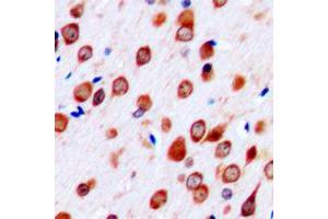 Immunohistochemical analysis of Neurotrimin staining in human brain formalin fixed paraffin embedded tissue section. (Neurotrimin anticorps  (C-Term))