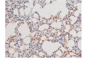 ABIN6267601 at 1/200 staining Mouse lung tissue sections by IHC-P. (NF-kB p65 anticorps  (pThr435))