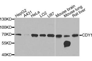 Western blot analysis of extracts of various cells, using CDY1 antibody. (CDY1 anticorps)