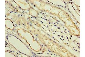 Immunohistochemistry of paraffin-embedded human kidney tissue using ABIN7156549 at dilution of 1:100 (IFNa14 anticorps  (AA 24-189))