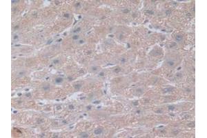 IHC-P analysis of Human Kidney Tissue, with DAB staining. (NOTCH4 anticorps  (AA 1715-2001))