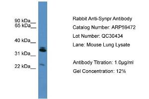 WB Suggested Anti-Synpr  Antibody Titration: 0. (Synaptoporin anticorps  (Middle Region))
