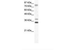 Image no. 1 for anti-Zinc Finger Protein 570 (ZNF570) (AA 68-117) antibody (ABIN6736005) (ZNF570 anticorps  (AA 68-117))