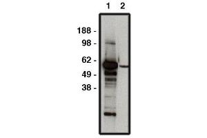 Western blot using FBXW7 antibody   used at 1:50k dilution. (FBXW7 anticorps)