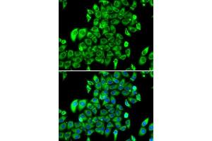 Immunofluorescence analysis of MCF-7 cells using RPL13 antibody. (RPL13 anticorps  (AA 1-211))