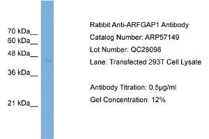 WB Suggested Anti-ARFGAP1  Antibody Titration: 0.