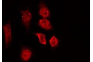 ABIN6266914 staining NIH-3T3 by IF/ICC. (CCDC99 anticorps  (C-Term))