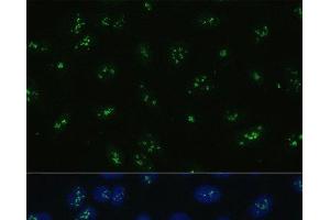 Immunofluorescence analysis of U-2 OS cells using NOLC1 Polyclonal Antibody at dilution of 1:100. (NOLC1 anticorps)