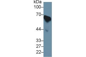 Western Blot; Sample: Human Serum; Primary Ab: 1µg/ml Rabbit Anti-Human CDC25B Antibody Second Ab: 0. (CDC25B anticorps  (AA 377-566))