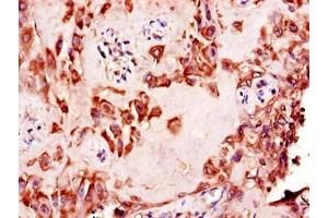 Immunohistochemistry of paraffin-embedded human placenta tissue using ABIN7156151 at dilution of 1:100 (NAALADL2 anticorps  (AA 143-795))
