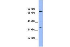 Image no. 1 for anti-Zinc Finger Protein 278 (ZNF278) (AA 35-84) antibody (ABIN6741631) (PATZ1 anticorps  (AA 35-84))
