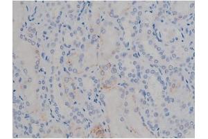 ABIN6267355 at 1/200 staining Human kidney tissue sections by IHC-P.