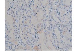 ABIN6267355 at 1/200 staining Human kidney tissue sections by IHC-P. (MAPT anticorps  (pSer356))