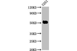 Western Blot Positive WB detected in: U251 whole cell lysate All lanes: FEZF1 antibody at 6 μg/mL Secondary Goat polyclonal to rabbit IgG at 1/50000 dilution Predicted band size: 53, 47, 52 kDa Observed band size: 53 kDa (FEZF1 anticorps  (AA 1-115))