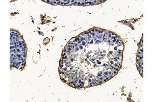 ABIN7096323 and ABIN7100385 at 1/100 staining mouse testis tissue by IHC-P.