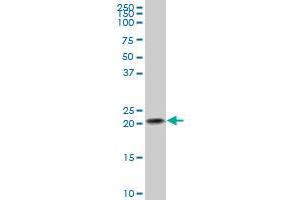 NDUFB10 polyclonal antibody (A01), Lot # 051122JC01.