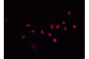 ABIN6268887 staining HeLa cells by IF/ICC. (PRKDC anticorps  (C-Term))