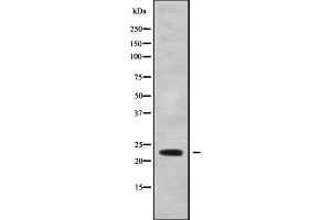 Western blot analysis of CDO1 using HeLa whole cell lysates