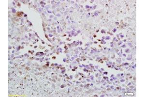 Formalin-fixed and paraffin embedded mouse lymphoma labeled with Anti-Oct-3/Oct-4 Polyclonal Antibody, Unconjugated  at 1:200 followed by conjugation to the secondary antibody and DAB staining. (OCT4 anticorps  (AA 201-300))