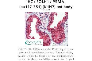 Image no. 2 for anti-Folate Hydrolase (Prostate-Specific Membrane Antigen) 1 (FOLH1) (AA 117-351) antibody (ABIN1723210) (PSMA anticorps  (AA 117-351))
