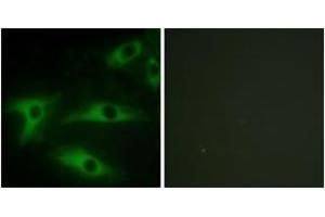 Immunofluorescence analysis of HeLa cells, using Collagen I alpha2 Antibody. (COL1A2 anticorps  (AA 471-520))