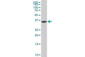 Western Blotting (WB) image for anti-Decapping Enzyme, Scavenger (DCPS) (AA 1-338) antibody (ABIN599227) (DCPS anticorps  (AA 1-338))