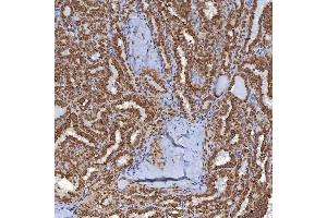 IHC analysis of TRMT61A using anti-TRMT61A antibody (ABIN7599220). (TRMT61A anticorps  (AA 1-289))