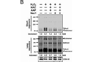 NAC/AAP decreased the activation of Drp1 inH2O2-treated hADMSCs.