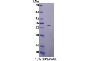 SDS-PAGE (SDS) image for Acyl-CoA Dehydrogenase, C-2 To C-3 Short Chain (Acads) (AA 210-397) protein (His tag) (ABIN6239322)