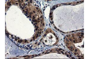 Image no. 8 for anti-CCR4-NOT Transcription Complex Subunit 4 (CNOT4) (AA 190-455) antibody (ABIN1491098) (CNOT4 anticorps  (AA 190-455))