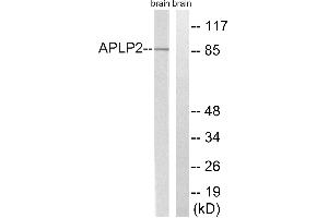 Western blot analysis of extracts from rat brain cells, using APLP2 (Ab-755) antibody. (APLP2 anticorps  (Tyr755))