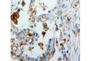 IHC-P analysis of Lung tissue, with DAB staining. (Surfactant Protein C anticorps  (AA 24-197))