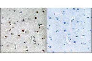 Immunohistochemistry analysis of paraffin-embedded human brain tissue, using RFX3 Antibody. (RFX3 anticorps  (AA 641-690))