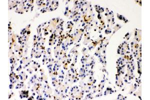 Immunohistochemistry (Paraffin-embedded Sections) (IHC (p)) image for anti-Parkinson Protein 7 (PARK7) (AA 2-189) antibody (ABIN3043589)