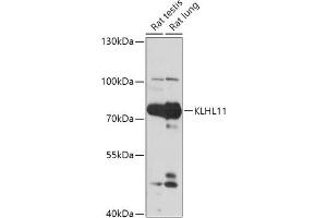 Western blot analysis of extracts of various cell lines, using KLHL11 antibody (ABIN7268078) at 1:1000 dilution. (KLHL11 anticorps  (AA 16-300))