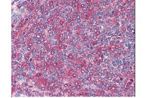 Image no. 1 for anti-Frizzled Family Receptor 7 (FZD7) (C-Term) antibody (ABIN374921) (FZD7 anticorps  (C-Term))