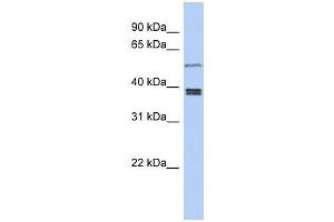 SS18L1 antibody used at 1 ug/ml to detect target protein. (SS18L1 anticorps  (Middle Region))