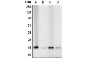 Western blot analysis of Cofilin expression in Jurkat (A), HeLa (B), MCF7 (C), A431 (D) whole cell lysates.