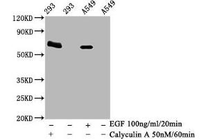 Western Blot Positive WB detected in 293 whole cell lysate 65549 whole cell lysate(treated with Calyculin A or EGF) All lanes Phospho-PRKAA2 antibody at 1. (Recombinant PRKAA2 anticorps  (pThr172))