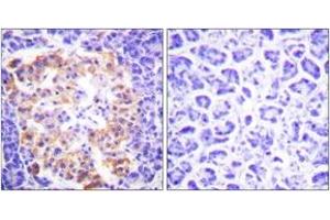 Immunohistochemistry analysis of paraffin-embedded human pancreas tissue, using Collagen III Antibody. (COL3 anticorps  (AA 81-130))