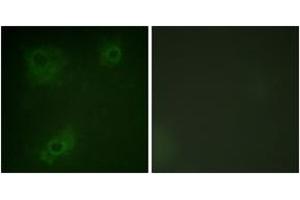 Immunofluorescence analysis of COS7 cells, using IRS-1 (Ab-323) Antibody. (IRS1 anticorps  (AA 289-338))