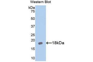 Western Blotting (WB) image for anti-Interleukin 18 Receptor Accessory Protein (IL18RAP) (AA 396-548) antibody (ABIN1174895) (IL18RAP anticorps  (AA 396-548))