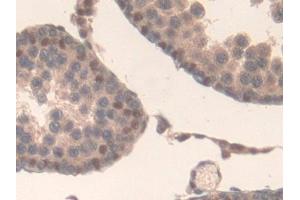 Detection of IL17RD in Rat Testis Tissue using Polyclonal Antibody to Interleukin 17 Receptor D (IL17RD) (IL17RD anticorps  (AA 356-605))