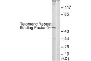 Western blot analysis of extracts from 293 cells, treated with Paclitaxel 1uM 24h, using Telomeric Repeat Binding Factor 1 (Ab-219) Antibody. (TRF1 anticorps  (AA 185-234))