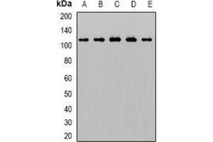 Western blot analysis of AP2-alpha-1 expression in THP1 (A), Hela (B), mouse brain (C), rat liver (D), rat lung (E) whole cell lysates.