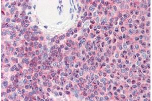 Human Spleen (formalin-fixed, paraffin-embedded) stained with CFL1 antibody ABIN364365 at 10 ug/ml followed by biotinylated anti-mouse IgG secondary antibody ABIN481714, alkaline phosphatase-streptavidin and chromogen. (Cofilin anticorps  (AA 1-166))