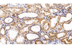 Detection of LIFR in Human Kidney Tissue using Polyclonal Antibody to Leukemia Inhibitory Factor Receptor (LIFR)