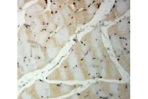 Used in DAB staining on fromalin fixed paraffin-embedded smooth muscle tissue (PDGF-BB Homodimer (AA 5-225) anticorps)