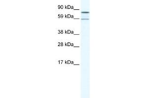 WB Suggested Anti-PARN Antibody Titration:  1. (PARN anticorps  (N-Term))