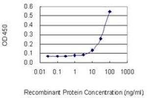 Detection limit for recombinant GST tagged HDAC11 is 3 ng/ml as a capture antibody.